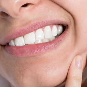 Close-up of a woman clenching her teeth in discomfort while pressing her hand against her cheek, indicating possible jaw pain or a dental issue.
