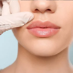 Close-up of a woman's lips receiving a cosmetic lip filler injection with a syringe, administered by a professional wearing white medical gloves, against a light blue background.