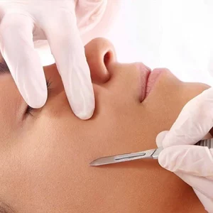 Close-up of a woman undergoing a dermaplaning treatment, with a gloved professional using a scalpel to exfoliate the skin on her cheek, aimed at removing dead skin cells and peach fuzz for a smoother complexion.