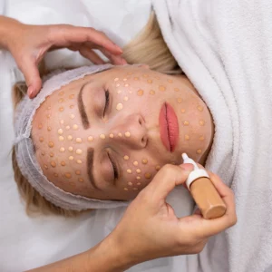 A woman lying down with her eyes closed during a cosmetic treatment, while a practitioner applies multiple small dots of foundation or serum evenly across her face using a dropper, indicating a skin tone-matching or facial rejuvenation procedure.