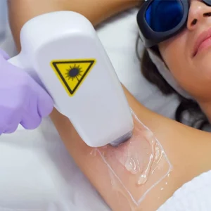 Woman receiving laser hair removal treatment on her underarm, wearing protective goggles while a technician uses a laser device on gel-applied skin.
