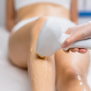 Close-up of a person undergoing laser hair removal treatment on their legs, with a gloved hand holding a laser device against the skin coated in gel.