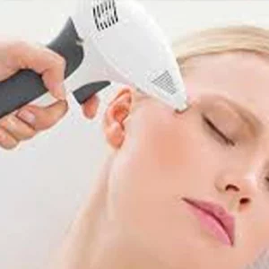 A woman receiving a cosmetic skin treatment on her face with a handheld laser or intense pulsed light (IPL) device, applied near the temple area while she lies with her eyes closed.