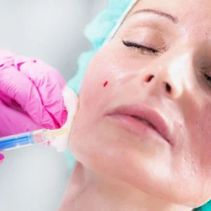 A woman receiving a cosmetic injection in her cheek by a medical professional wearing pink gloves. The woman has her eyes closed and is wearing a blue surgical cap. A small drop of blood is visible on her cheek near the injection site, indicating a dermal filler or aesthetic treatment procedure.