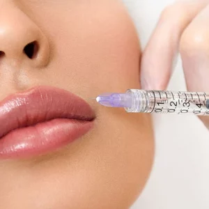 Close-up of a woman's lips with a syringe near the upper lip, suggesting a cosmetic lip filler or injection procedure, with a gloved hand holding the syringe.