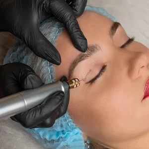 Close-up of a woman receiving a cosmetic eyelid procedure with a plasma pen device, performed by a professional wearing black gloves. The woman is lying down with eyes closed, wearing a blue hair cap and red lipstick.
