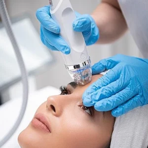 Close-up of a woman receiving a professional facial treatment with a skin rejuvenation or microdermabrasion device operated by a specialist wearing blue gloves.
