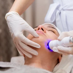 A professional in white gloves performs a facial skin treatment using a handheld device emitting blue light on a patient’s chin, in a clinical or spa setting.