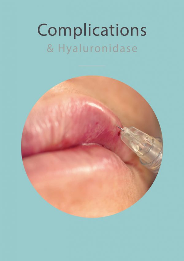 Close-up of a syringe injecting into a person's upper lip, illustrating a treatment for complications related to dermal fillers using hyaluronidase.