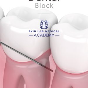 3D illustration of a dental block procedure showing a needle inserted into the gum near the roots of two molar teeth.