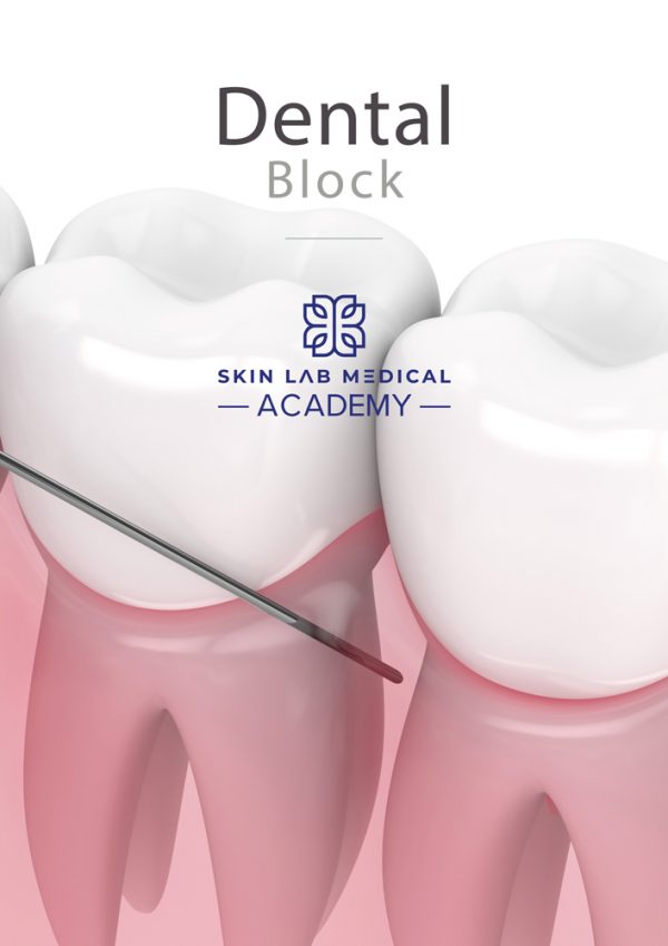 3D illustration of a dental block procedure showing a needle inserted into the gum near the roots of two molar teeth.