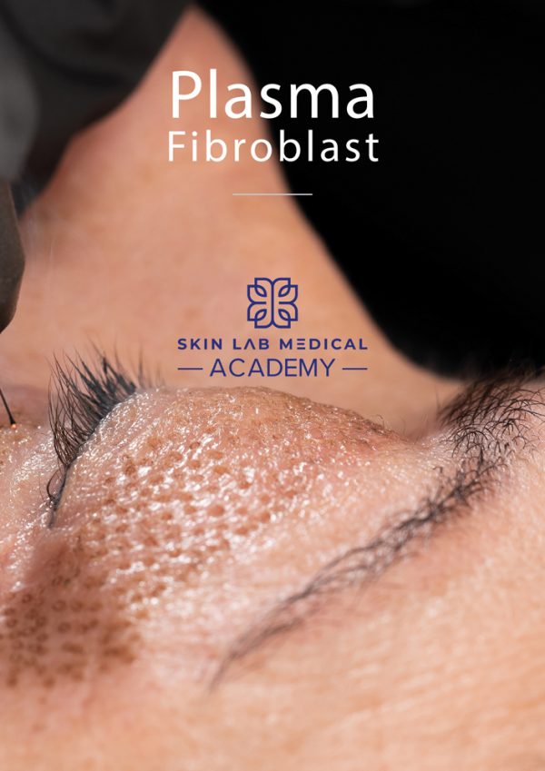 Close-up of Plasma Fibroblast skin tightening procedure on eyelid area at Skin Lab Medical Academy.