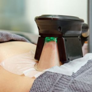 Cryotherapy - Fat Freeze