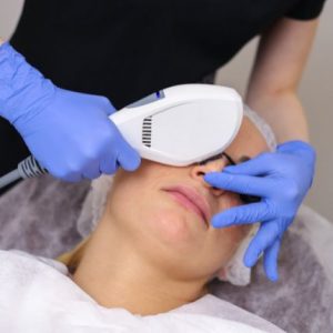 IPL Skin Rejuvenation