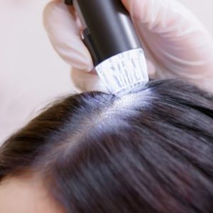 Beginner Scalp Micro Pigmentation Training Course