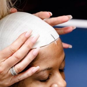 Beginner Scalp Micro Pigmentation Training Course