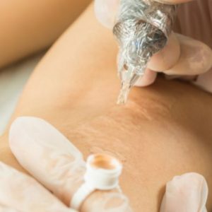 Scar and Stretch Mark Camouflage Training Course